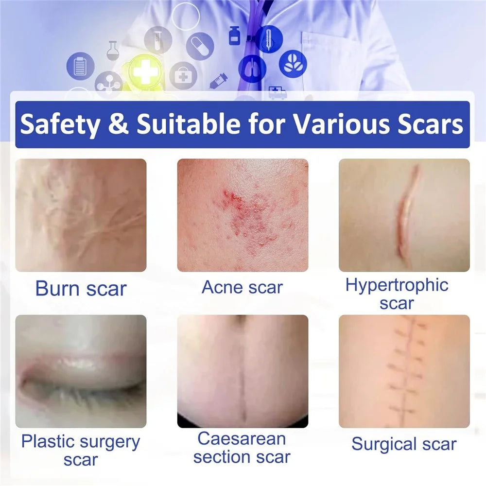 4cm Silicone Scar Removal Tape Post Surgery Scar Treatment Sheet Painless Scar Repair Bandage , Length 300cm - Transparent - 5