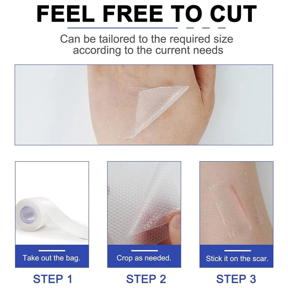 4cm Silicone Scar Removal Tape Post Surgery Scar Treatment Sheet Painless Scar Repair Bandage , Length 300cm - Transparent - 6