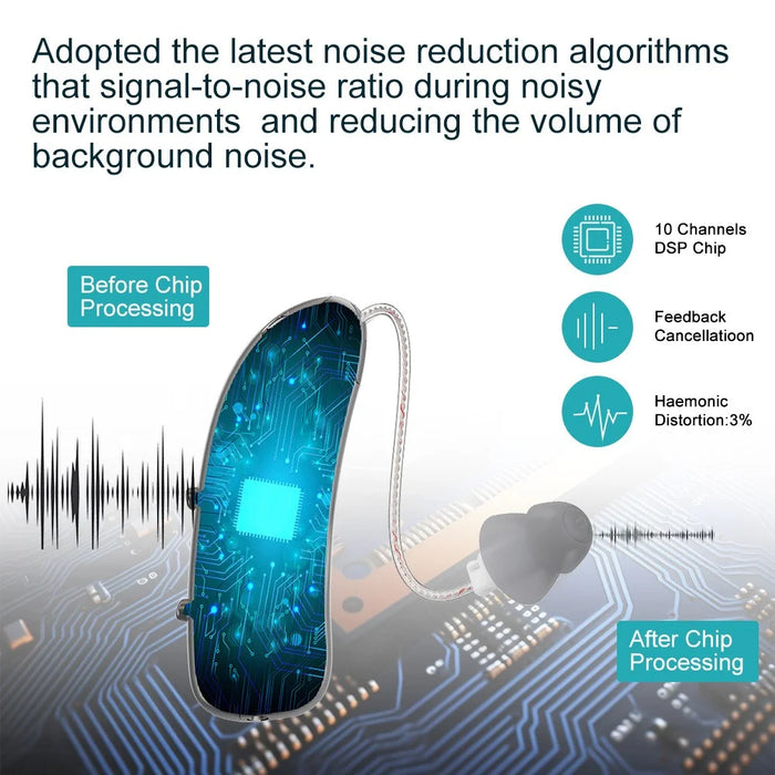 R03L1 RIC Digital Hearing Aid Noise Reduction Bluetooth-compatible Sound Amplifier for Deaf Elderly (Single Ear) - Left Ear - 5