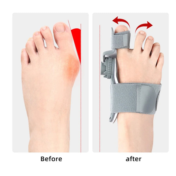 008 1Pc Adjustable Bunion Corrector Foot Hallux Valgus Brace Rotatable Toe Separator Straightener - Grey - 4