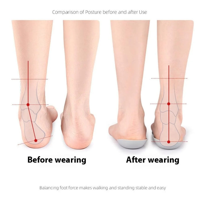 039 1 Pair Size L Magnetic Arch Support Insoles Half Length TPR Shock Absorbing Orthotic Insert Pad - Grey - 5