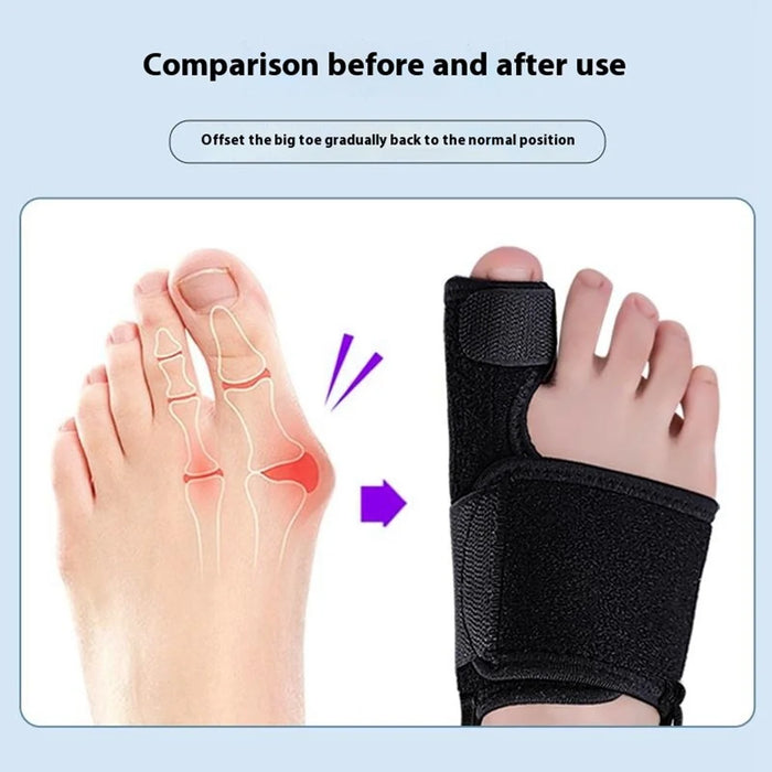 003 1Pc Toe Separator Corrector Bunion Splint Adjustable Support Brace for Hallux Valgus / Foot Pain Relief - Black / Right - 5