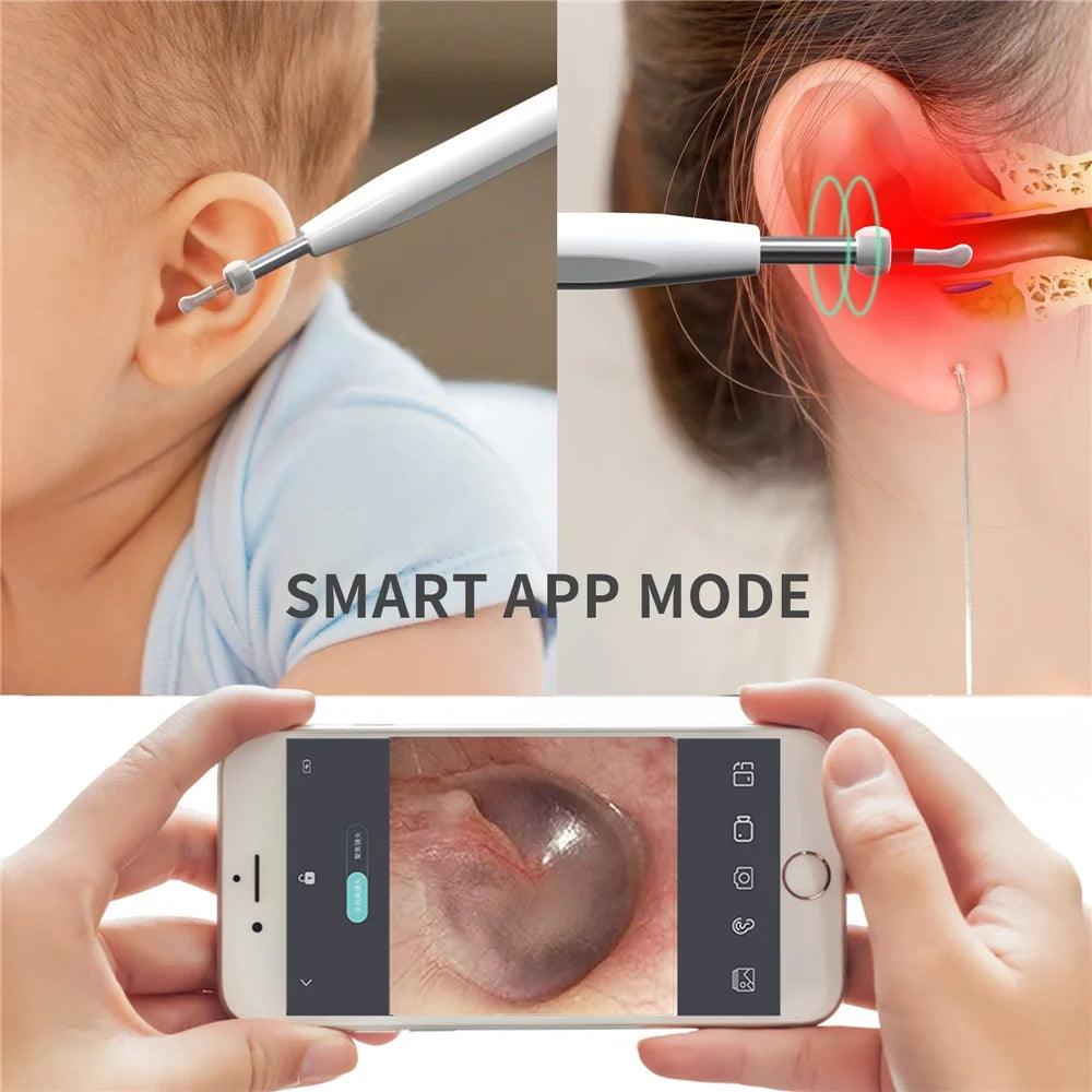 W2 Ear Camera Otoscope Ear Wax Removal Tool Kit LED Light Ear Pick Spoon Earwax Remover - Black - 2