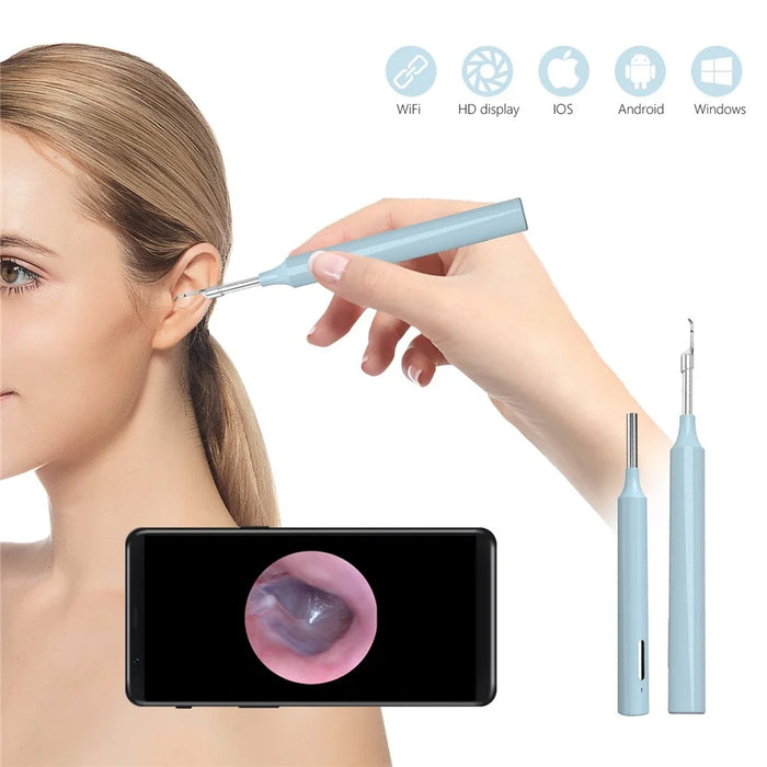Z10 WiFi Visual Earwax Removal Tool Wireless Earwax Cleaner Digital Otoscope Ear Wax Cleaning Tool - Blue - 2