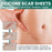 EELHOE 1 Roll Silicone Scar Removal Sheets for C-Section Postoperative Skin Colored Invisible Beauty Tape - 3