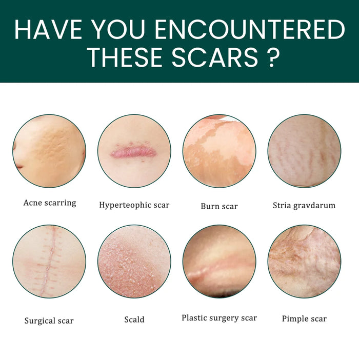 EELHOE 1 Roll Silicone Scar Removal Sheets for C-Section Postoperative Skin Colored Invisible Beauty Tape - 7