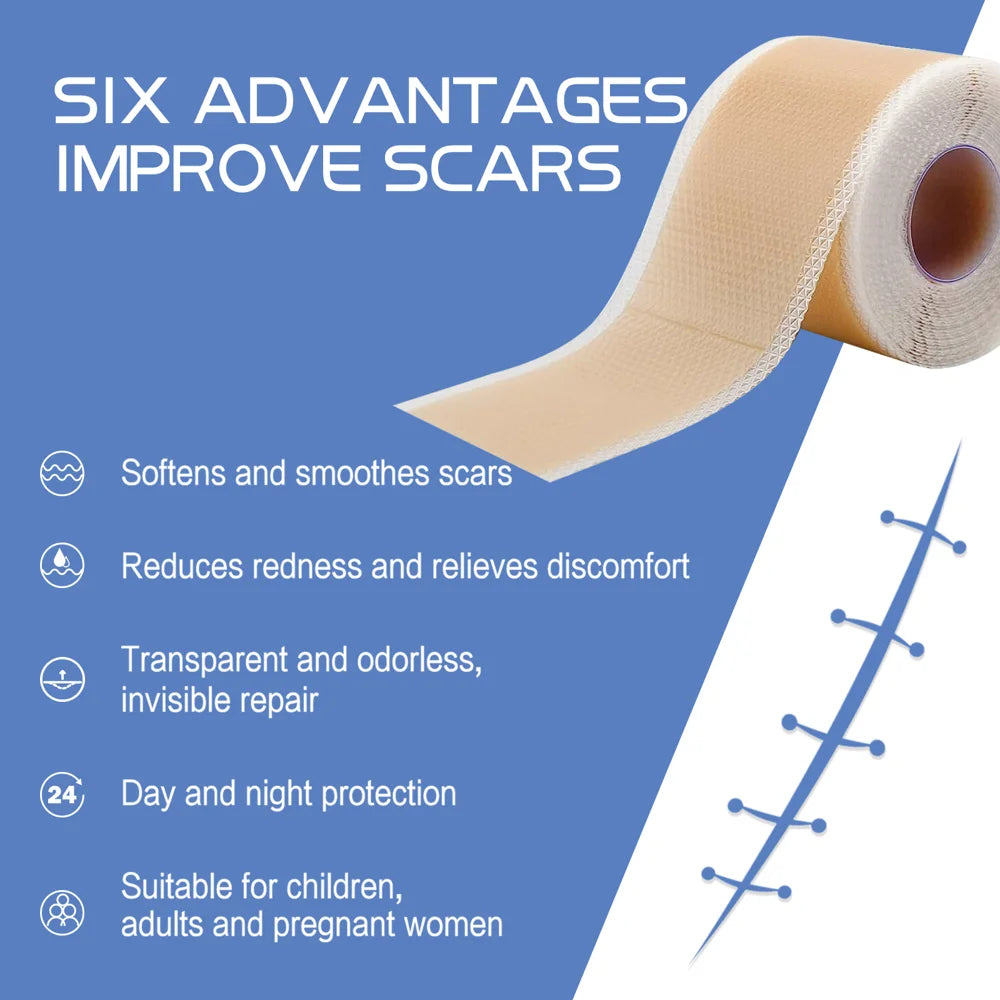 SOUTH MOON Silicone Scar Removal Sheets 4 x 150cm Surgical Scar Treatment Waterproof Breathable Scar Therapy Patches - 3