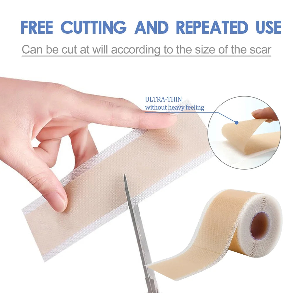 SOUTH MOON Silicone Scar Removal Sheets 4 x 150cm Surgical Scar Treatment Waterproof Breathable Scar Therapy Patches - 5