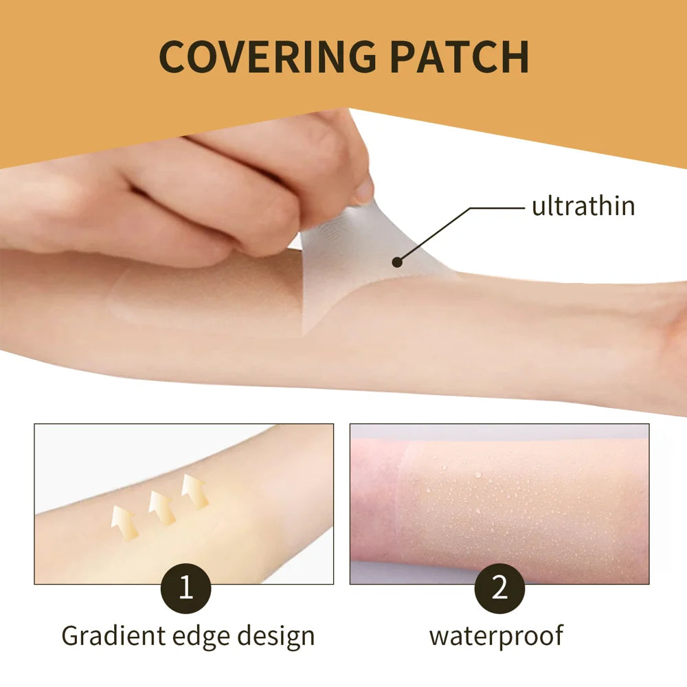 JAYSUING 6PCS Invisible Concealer Patches Waterproof Breathable Skin Tone Cover for Scars Tattoos Blemishes - 5