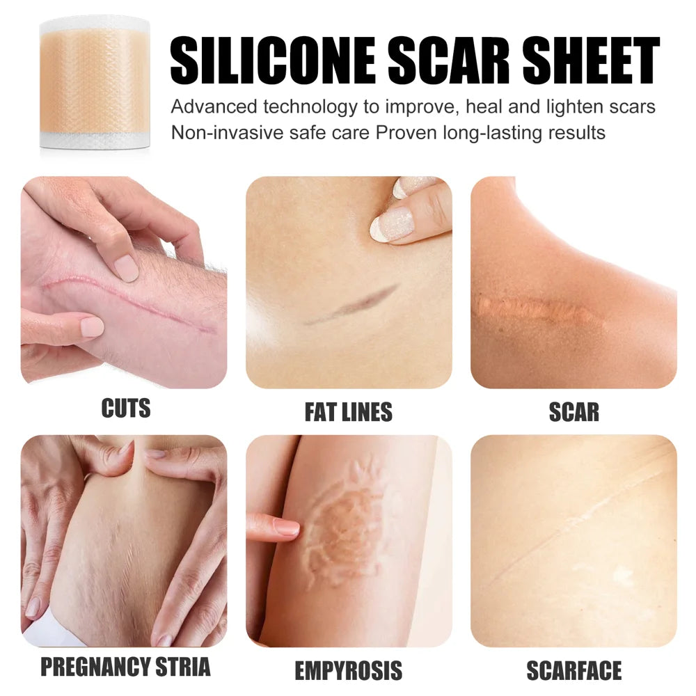 WEST&MONTH Silicone Scar Sheets Self-Adhesive Scar Tapes for Stretch Marks / Skin Repair / Smooth Skin Care - 3