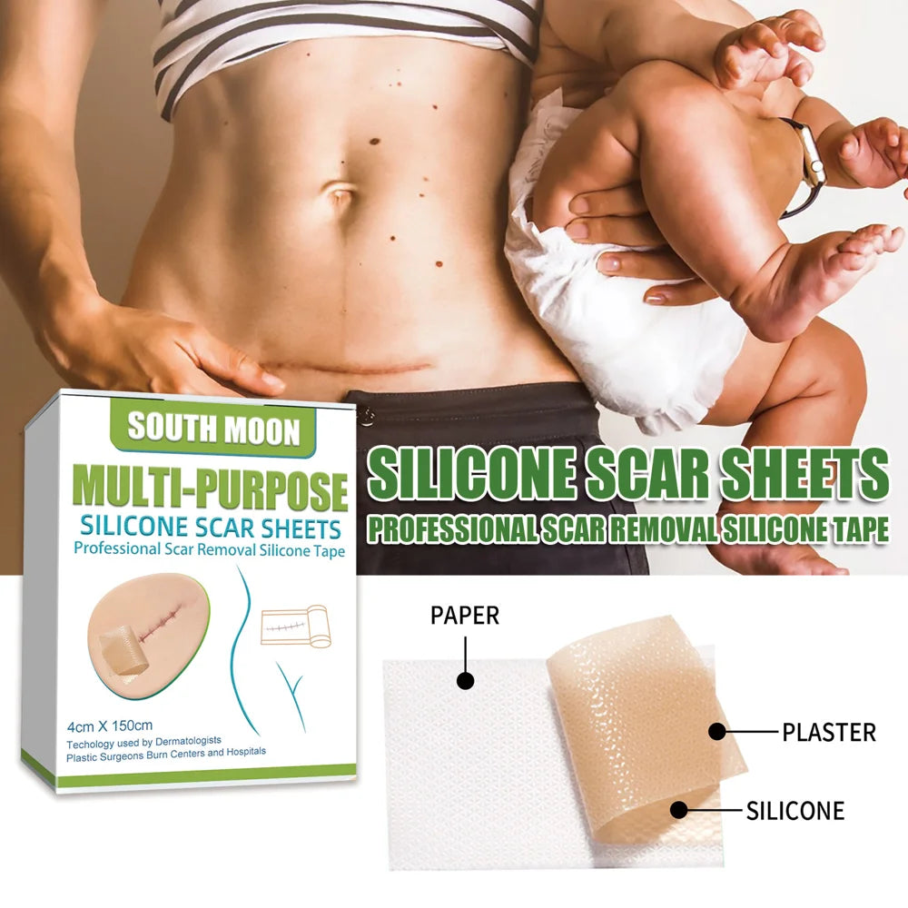 SOUTH MOON Silicone Scar Sheets Medical-Grade Scar Removal Patches Skin Repair Treatment for Post Surgery Acne Marks - 2