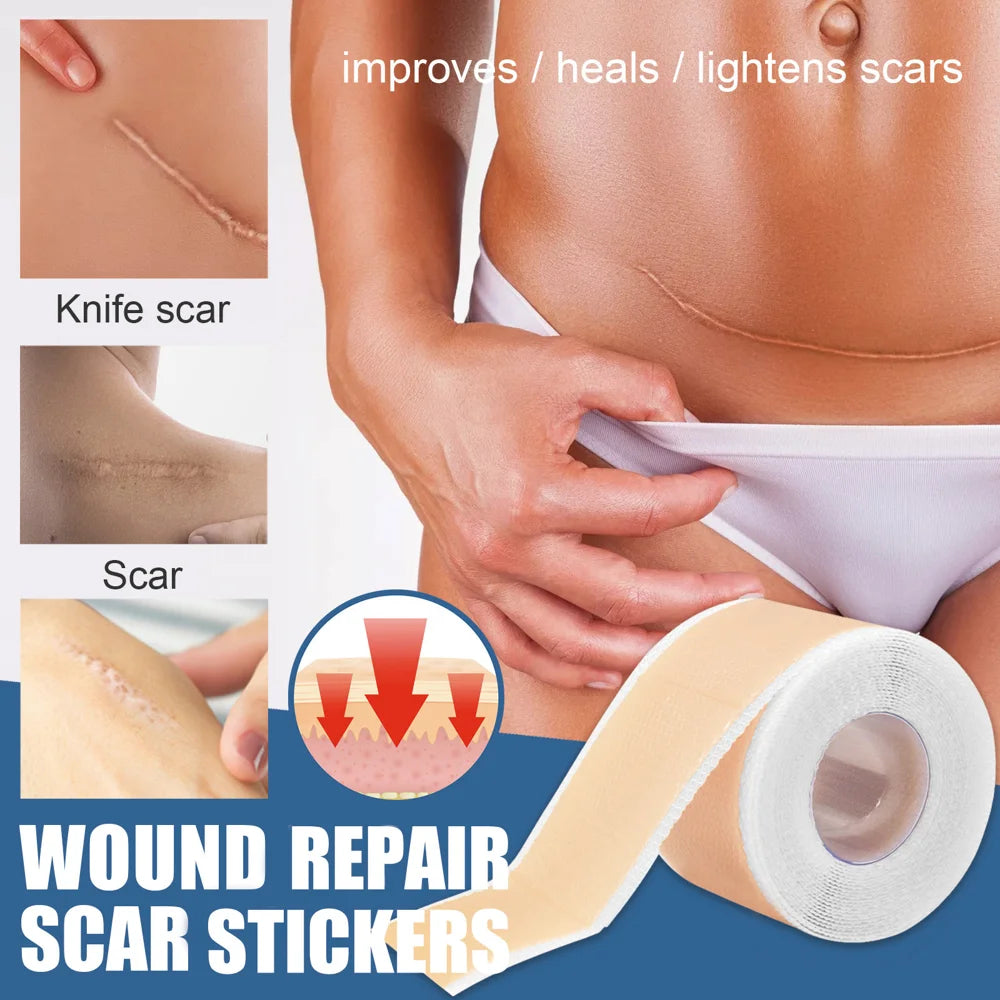 SOUTH MOON Silicone Scar Sheets Medical-Grade Scar Removal Patches Skin Repair Treatment for Post Surgery Acne Marks - 3