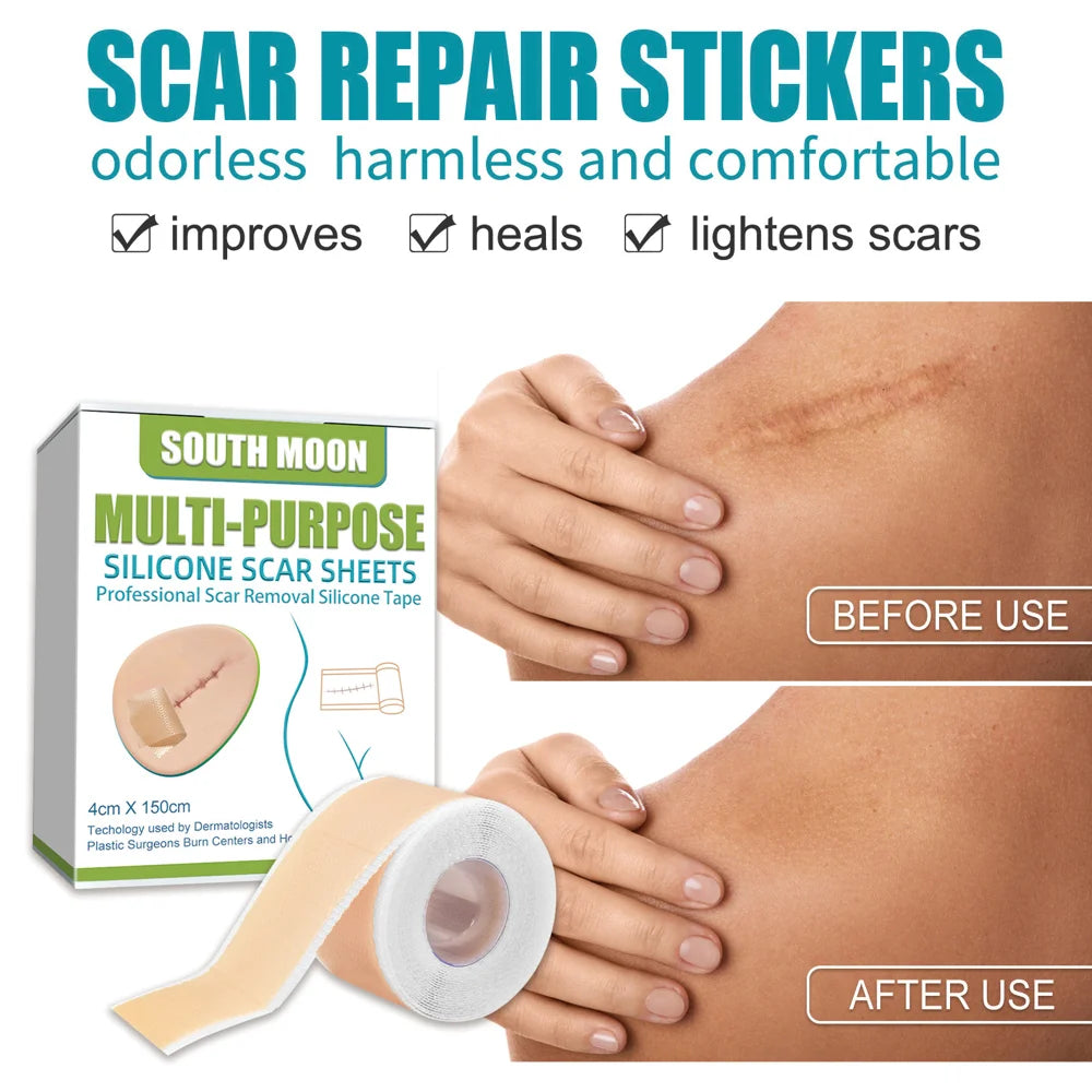 SOUTH MOON Silicone Scar Sheets Medical-Grade Scar Removal Patches Skin Repair Treatment for Post Surgery Acne Marks - 5