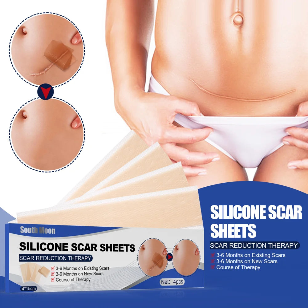 SOUTH MOON 4Pcs Silicone Scar Sheets Self Adhesive Burn Wound Healing Skin Smoothing Patches - 2