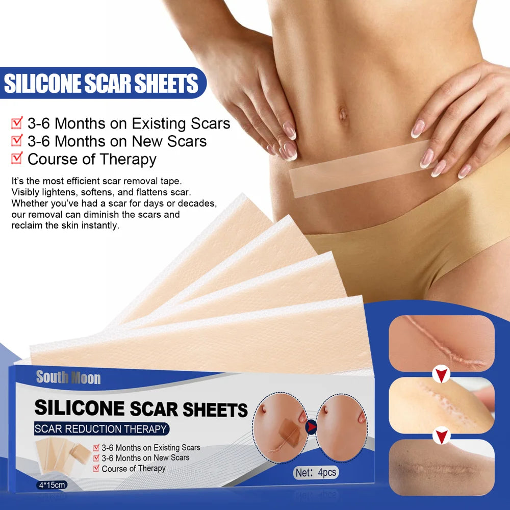 SOUTH MOON 4Pcs Silicone Scar Sheets Self Adhesive Burn Wound Healing Skin Smoothing Patches - 3