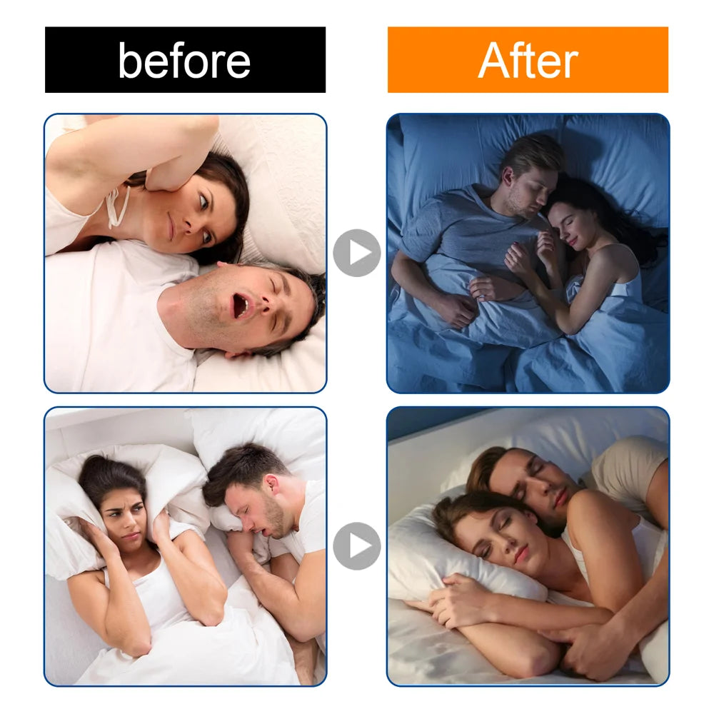 South Moon 60PCS Anti Snoring Strips For Adults Night Mouth Strips Instant Nasal Breathing Aid - 6