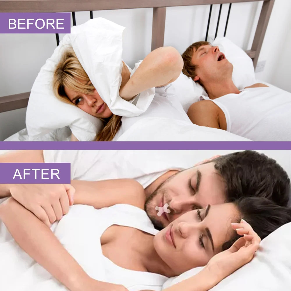 OUHOE 120Pcs Anti Snoring Mouth Tape Physical Breathing Aid Sleep Strips Improve Sleeping Mouth Sticker - 120Pcs - 6