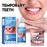 SOUTH MOON 30ml Temporary Teeth Replacement Filling Kit Moldable False Teeth Beads for Missing, Cracked DIY Denture - 2