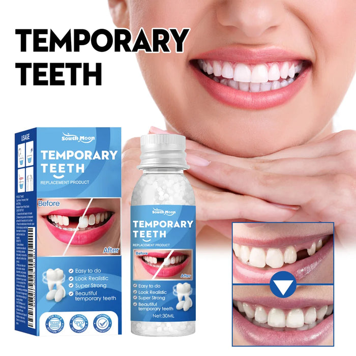 SOUTH MOON 30ml Temporary Teeth Replacement Filling Kit Moldable False Teeth Beads for Missing, Cracked DIY Denture - 2