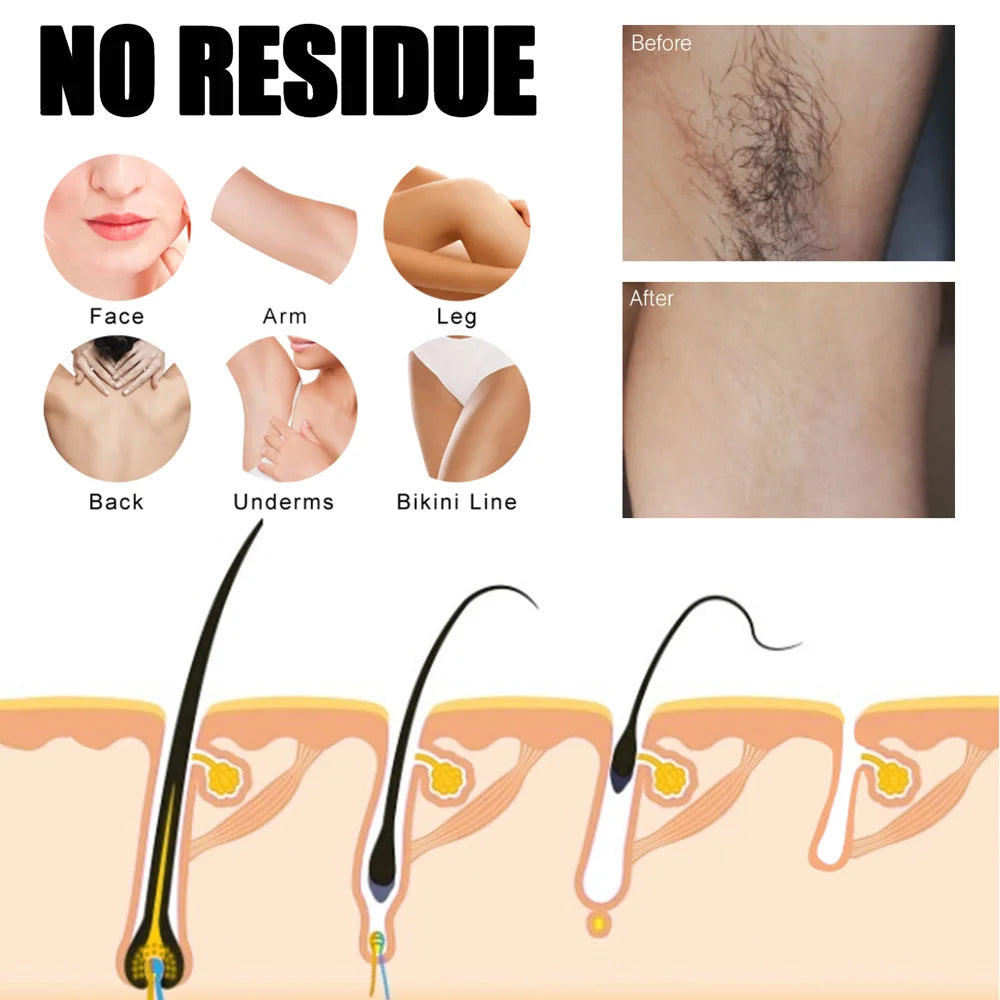 EELHOE 1 Set Hair Removal Wax Strips Kit Natural Hair Remover for Face, Eyebrow, Arms, Legs, Underarm, and Bikini - 6