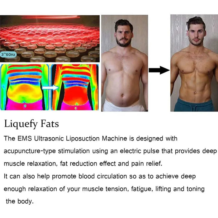 EMS Ultrasonic Liposuction Machine Portable Fitness Workout Equipment with 6 Modes and 10 Intensities - 3