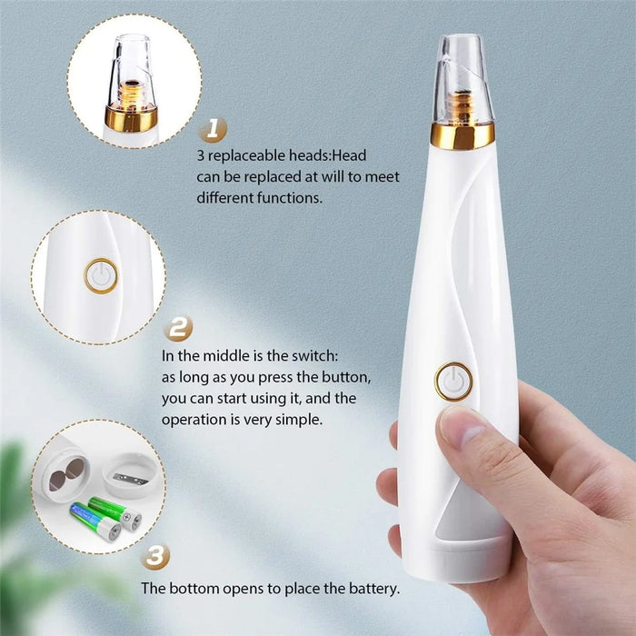 Blackhead Remover Vacuum Pore Cleaner Pimple Extractor Acne Removal Kit with 3 Replaceable Heads and 5 Needles - 2