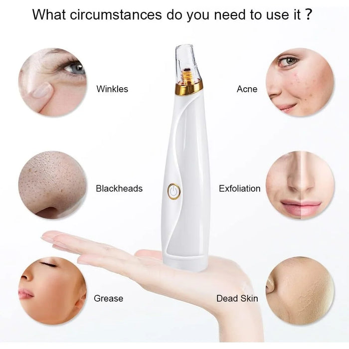 Blackhead Remover Vacuum Pore Cleaner Pimple Extractor Acne Removal Kit with 3 Replaceable Heads and 5 Needles - 4
