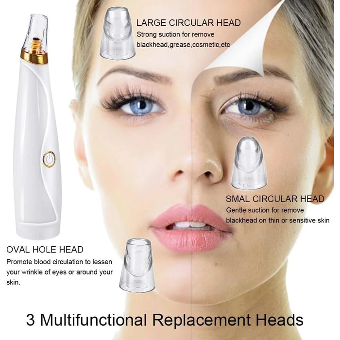Blackhead Remover Vacuum Pore Cleaner Pimple Extractor Acne Removal Kit with 3 Replaceable Heads and 5 Needles - 6