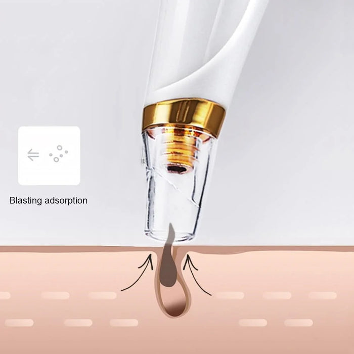 Blackhead Remover Vacuum Pore Cleaner Pimple Extractor Acne Removal Kit with 3 Replaceable Heads and 5 Needles - 7