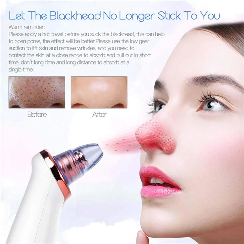 USB Rechargeable Pore Cleanser 3 Suction Levels Blackhead Extractor with 5 Heads Skin Care Tool - 2