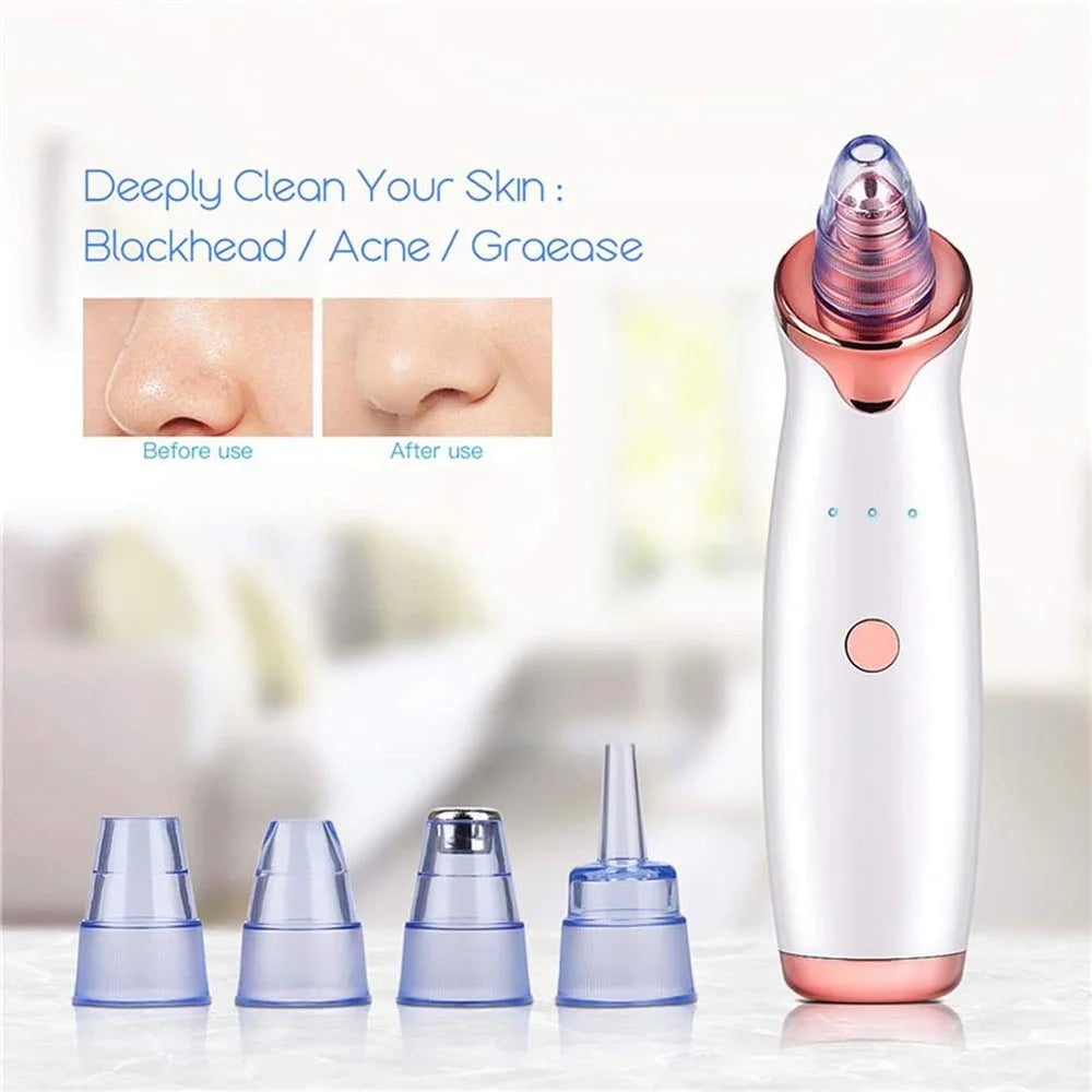 USB Rechargeable Pore Cleanser 3 Suction Levels Blackhead Extractor with 5 Heads Skin Care Tool - 3