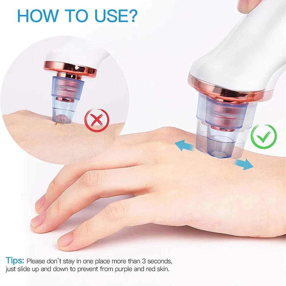 USB Rechargeable Pore Cleanser 3 Suction Levels Blackhead Extractor with 5 Heads Skin Care Tool - 4