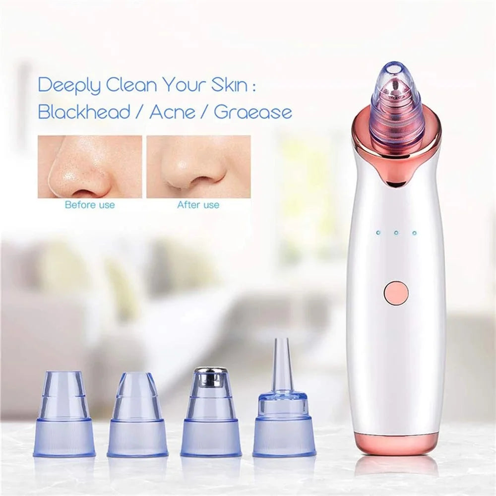 Blackhead Remover Pore Vacuum Cleaner with 5 Suction Heads and Pimple Needles Skin Care Tool Set - 2