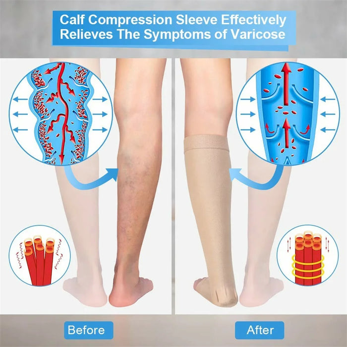 Size M 20-30mmHg Compression Calf Sleeve Breathable Open Toe Stockings for Varicose Veins, Skin Color - 3