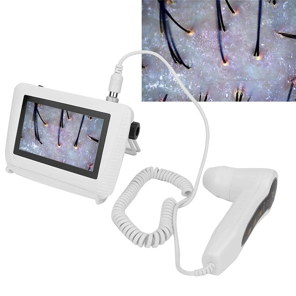 5 Inch Scalp Detector Digital Skin Analyzer Live Image Skin Microscope with 50X  /  200X Magnification Lens - US Plug - 2