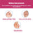 HOUKEA HKB05-A005-1-RD1 1 Pair Silicone Toe Corrector Toe Separator Hallux Valgus Correction Toe Cover - 5