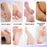 8Pcs / Set Professional Foot Care Pedicure Callus Dead Skin Remover Foot File Corn Removal Tool - 3