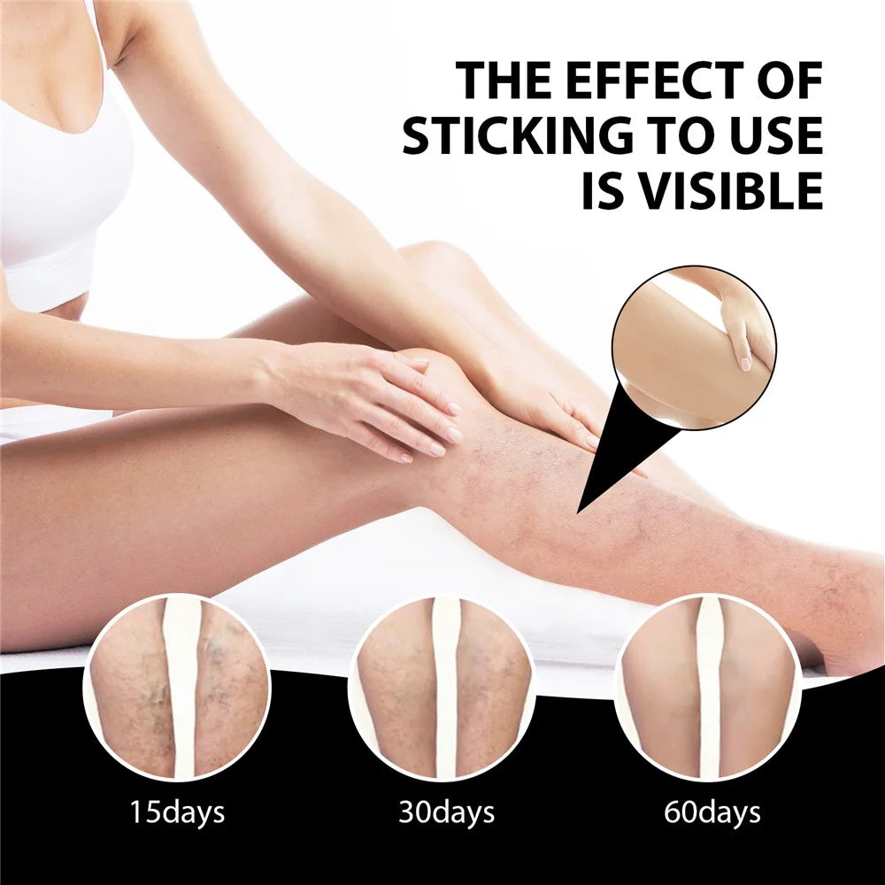 SOUTH MOON SOA06-A082-1-BK1 Breathable Ice Silk Insoles Varicose Veins Joint Pain Relief Foot Pads - 5