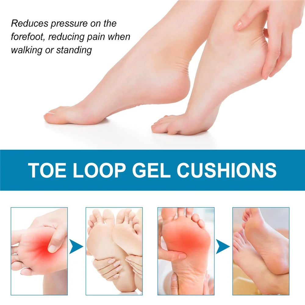SOUTH MOON SOA08-A059-2-BU1 1 Pair Metatarsal Pads Forefoot Pressure Reducer Toe Loop Gel Cushions - 4