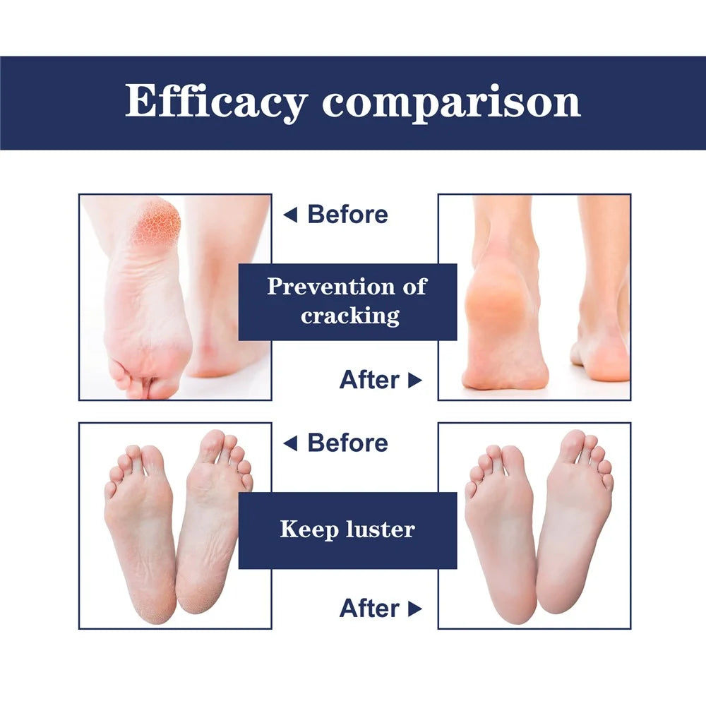 SOUTH MOON SO062210311 1 Pair Silicone Heel Protector Pad Moisturizing Anti Crack Foot Care Sleeve - 4