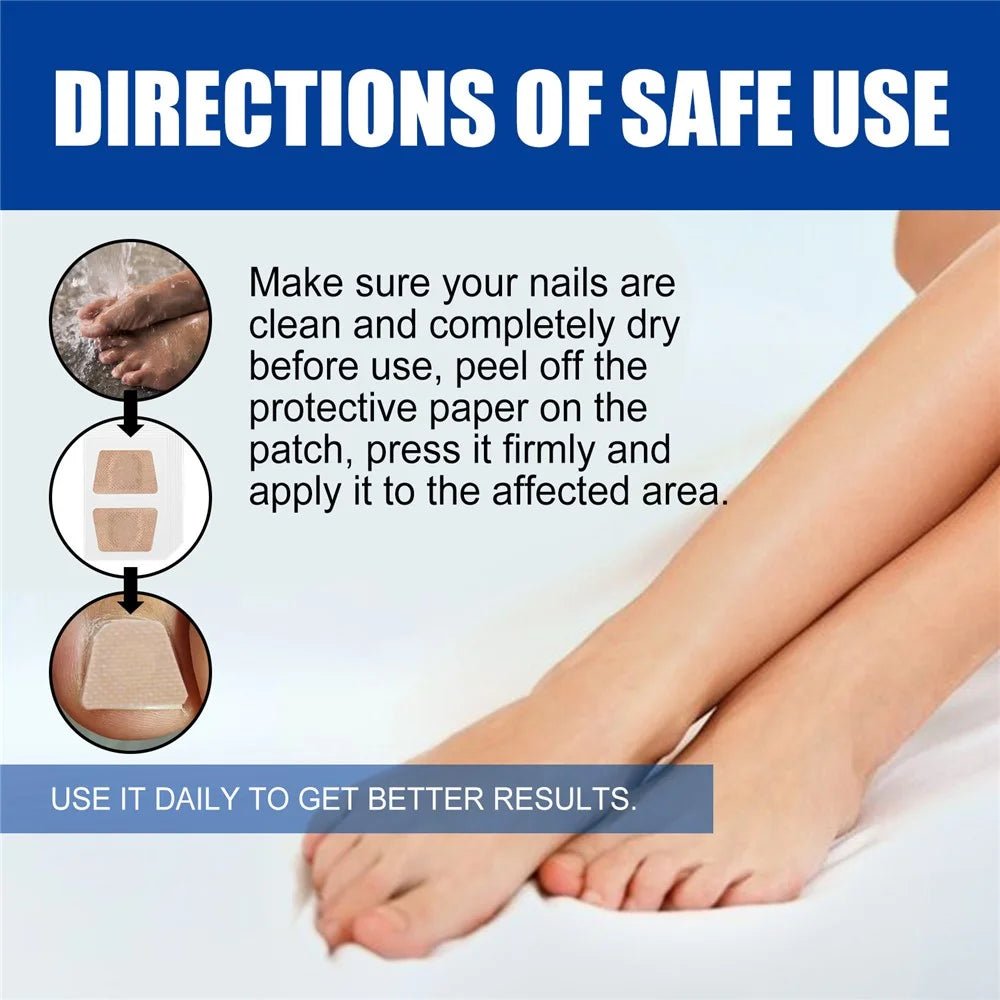 XIMONTH XIB05-A006-32-BU1 32Pcs Fungal Nail Patches Ingrown Toenail Overnight Repair Treatment - 5