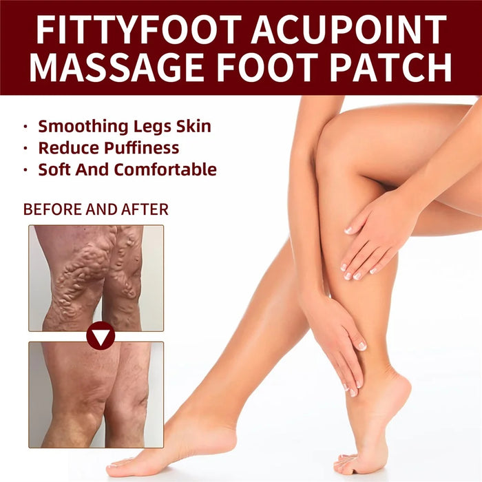 XIMONTH XIA03-A005-5-RD1 5 Pairs Acupoint Massage Foot Patch Relieve Venous Swelling Foot Care Pad - 2