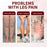 XIMONTH XIA03-A005-5-RD1 5 Pairs Acupoint Massage Foot Patch Relieve Venous Swelling Foot Care Pad - 4
