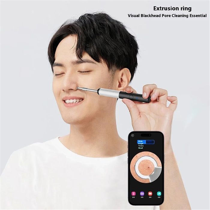 P80 High Definition 1920P Wireless Smart Ear Cleaning Endoscope Ear Wax Removal Tool Kit, Standard Version - Black - 3