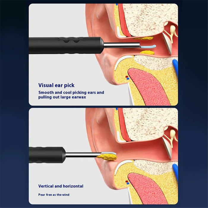 Smart HD WiFi App Connecting Visual Ear Pick Set Metal Integrated Ear Spoon, Upgraded Version - Black - 3
