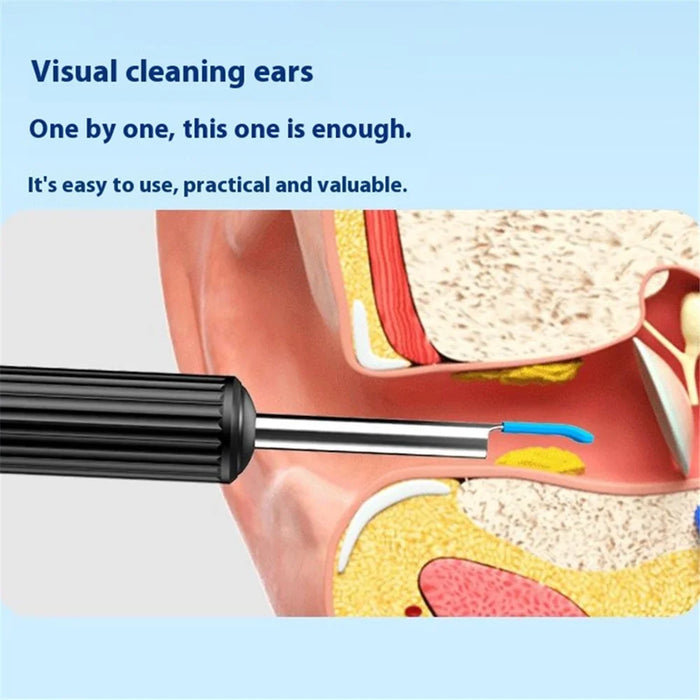 Visual Ear Cleaning Endoscope with LED Light Earwax Removal Tool Kit, Upgraded Version - Black - 2