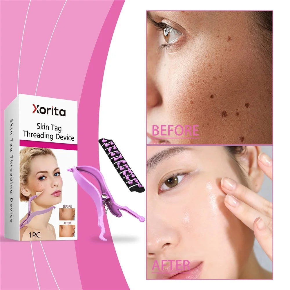 XORITA XO-A08-0005-01 Skin Tag Threading Device Smooth Skin Care Treatment for Face Body - 3