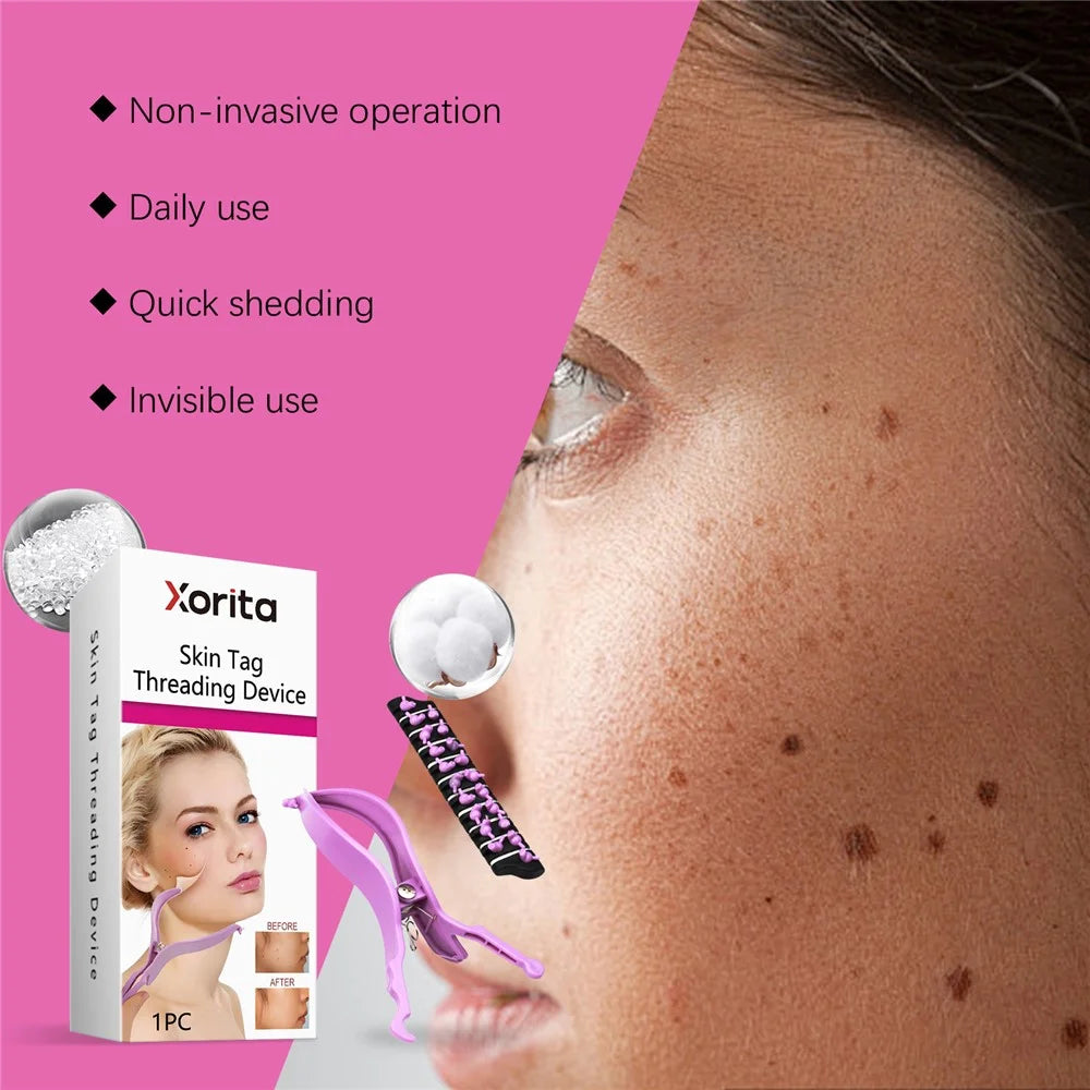 XORITA XO-A08-0005-01 Skin Tag Threading Device Smooth Skin Care Treatment for Face Body - 6