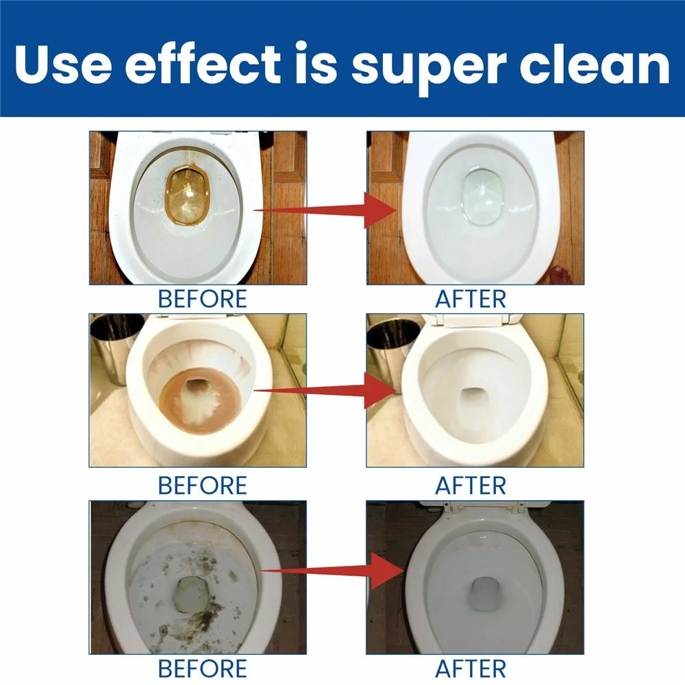 JAYSUING JA082302211 12Pcs Toilet Bowl Cleaning Tablets Stain Remover Deodorizer for Home Hotel - 6