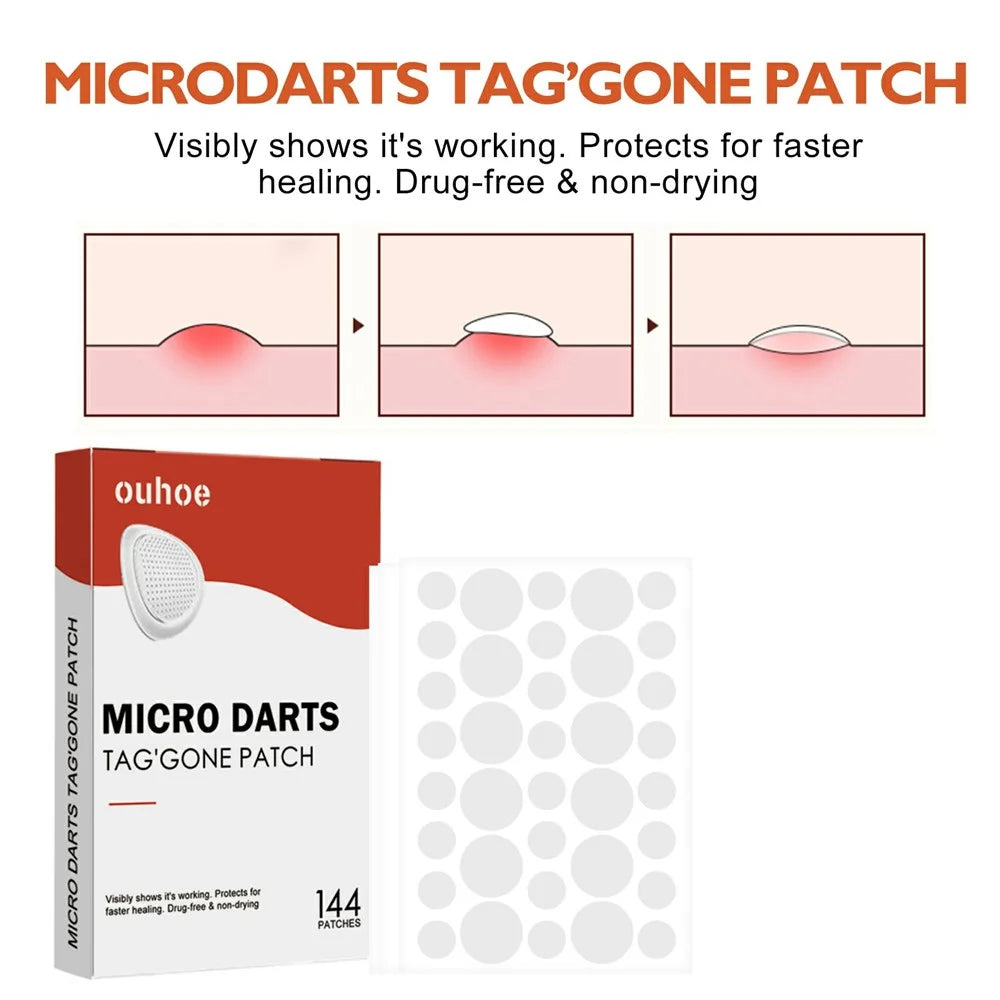 OUHOE 144Pcs Acne Patches Non Irritating Skin Blemish Treatment Pimple Sticker, OUA03-A039-144-WH1 - 3
